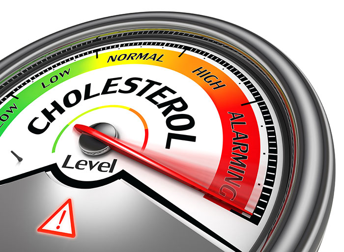 How to Keep High Cholesterol Levels at Bay