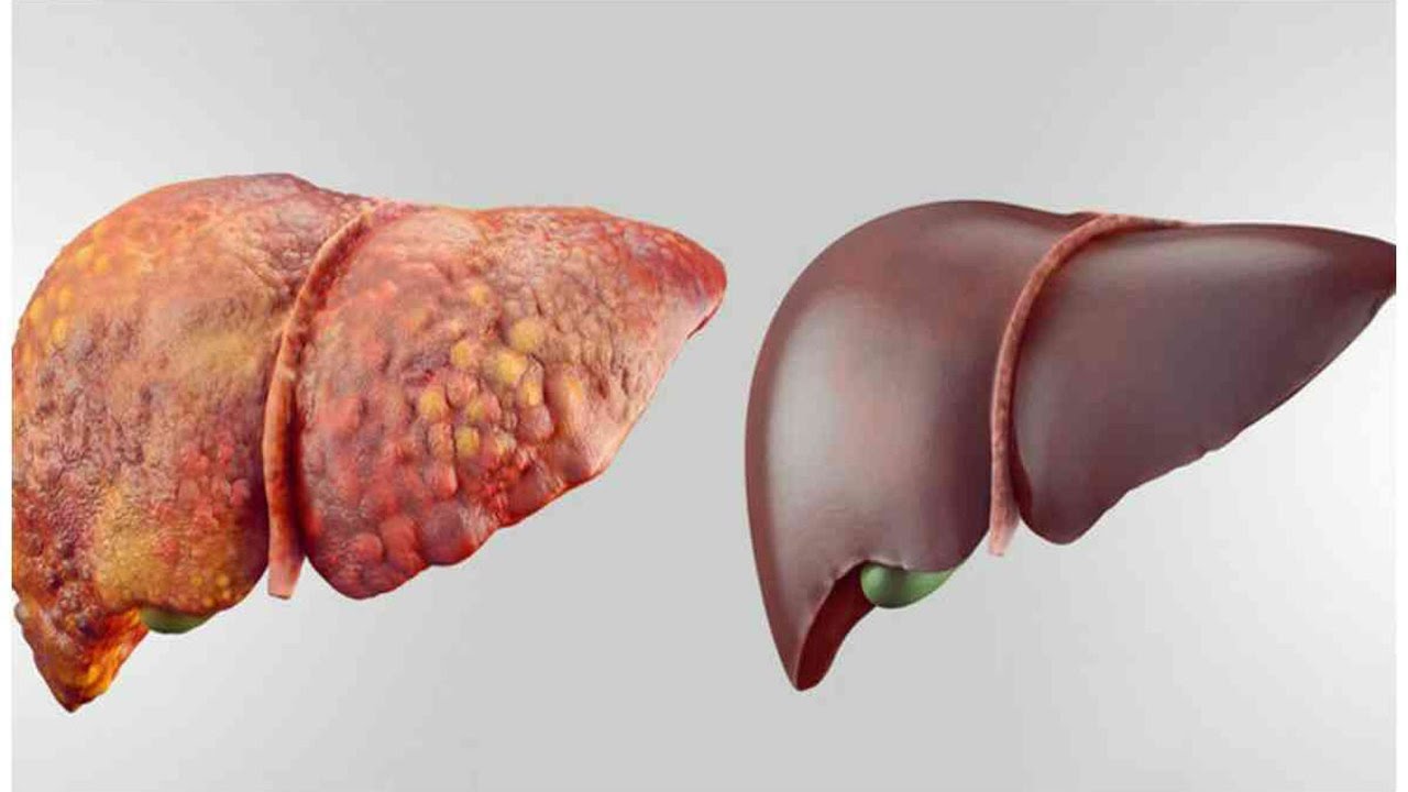 Why is it Important to Keep our Liver in Good Shape?